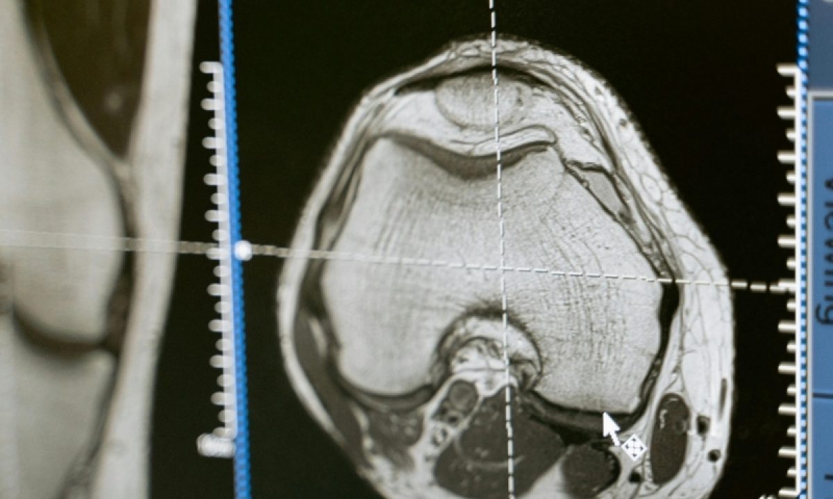 20250616_161119_original_787_CAPA_tres_lagoas_ressonanacia_-_MAURICIO