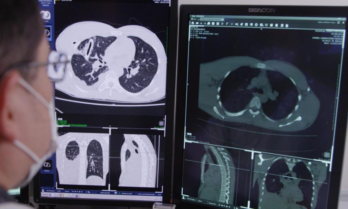 86-bloco-a001-c040-01010j-0003462