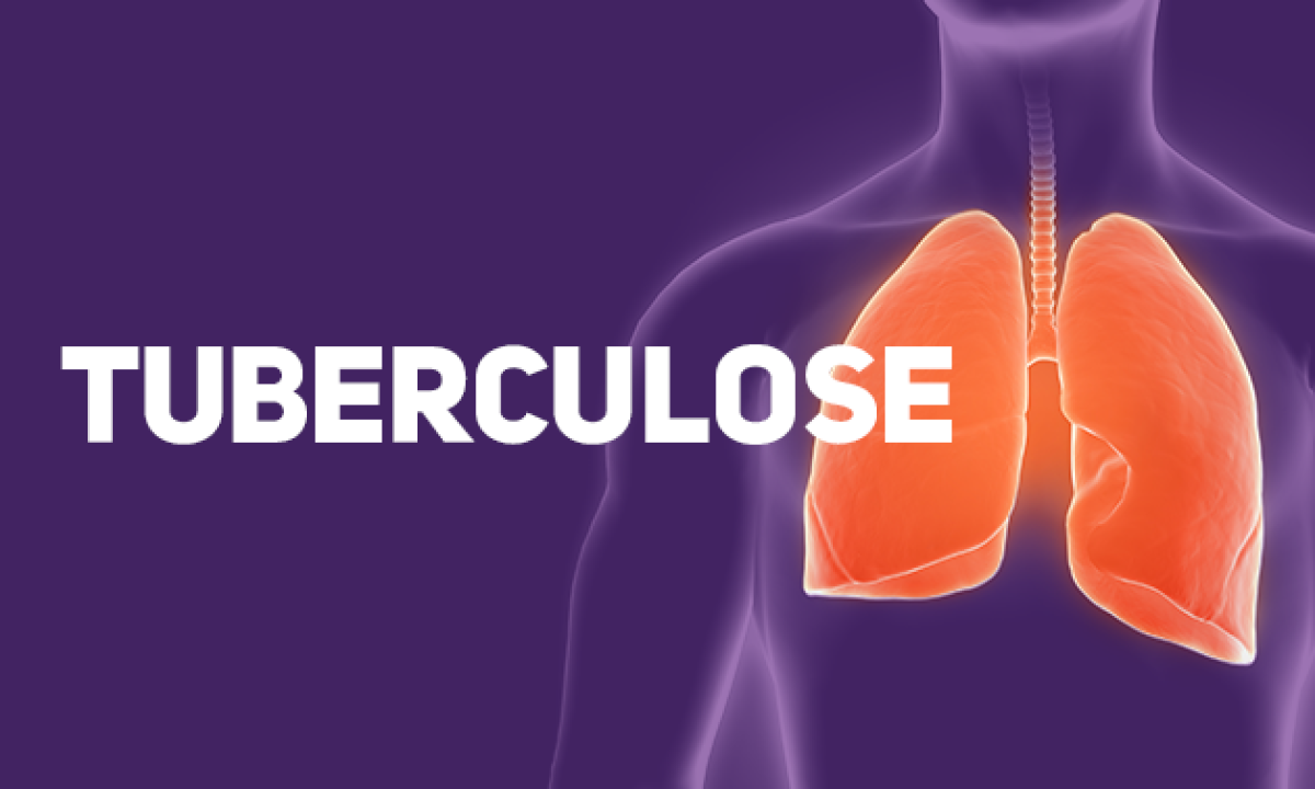Tuberculose