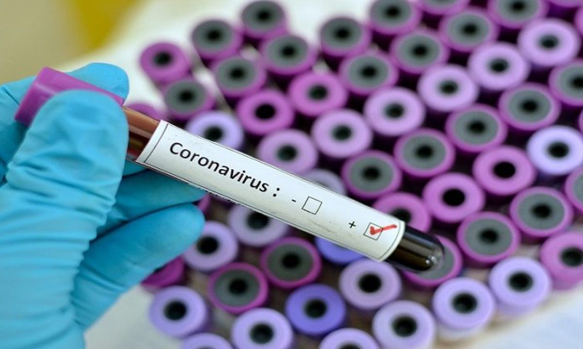 coronavirus-teste-1-730x425