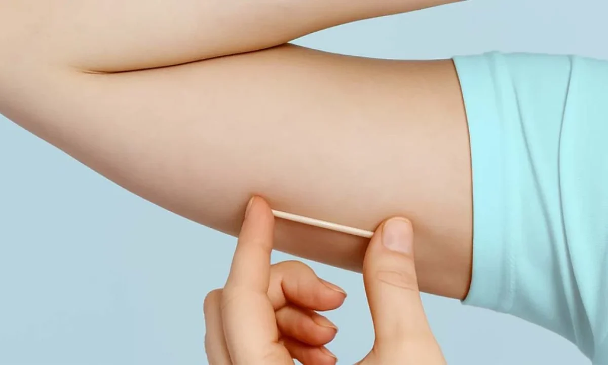 implanon-hero-1200x675