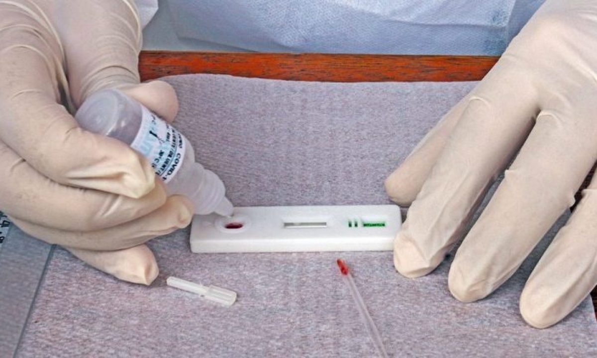 teste-COVID-19-Foto-Saul-Schramm-768x425-730x425 (1)