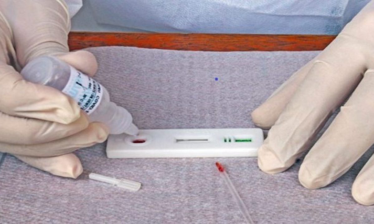 teste-covid-capa-730x425 (1)