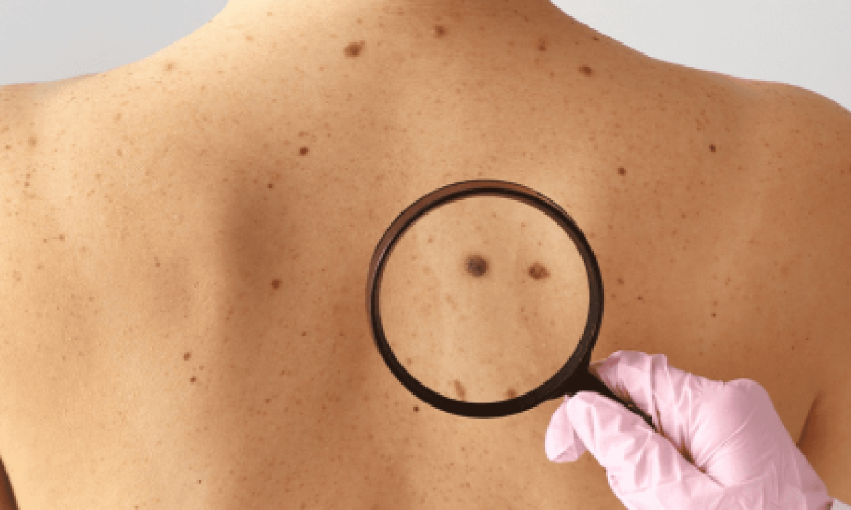 unnamed-scaled-420x280_c